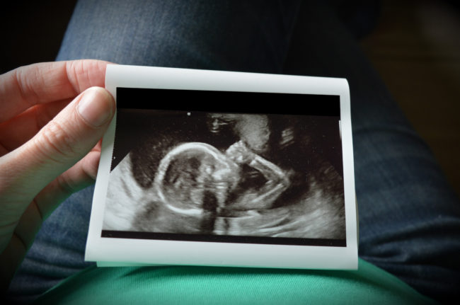 Како је трудна тинејџерка одбила да абортира – прича о Донан и малом Шону